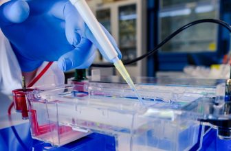 SDS PAGE Electrophoresis